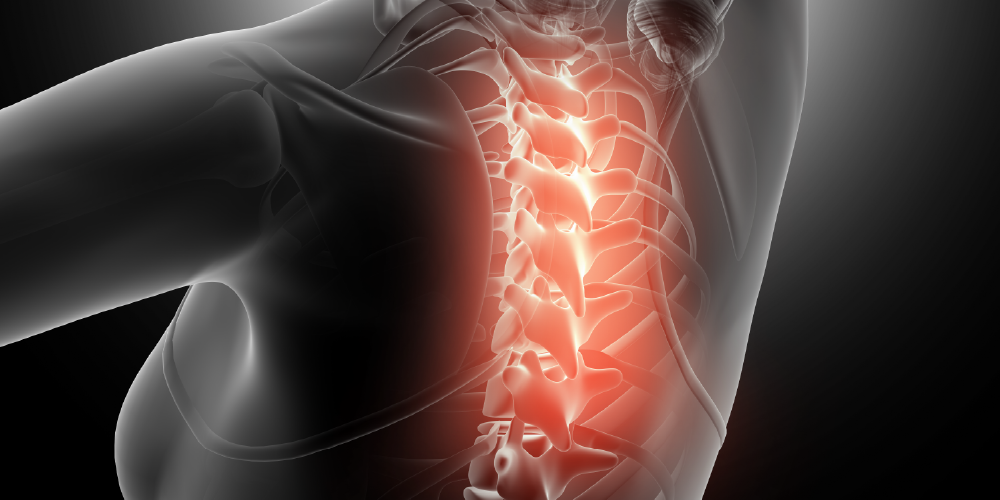 Spinal Arthritis Image